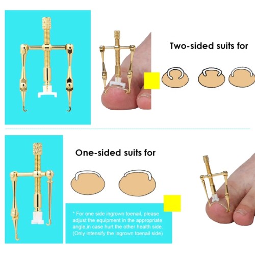 Nail Corrector