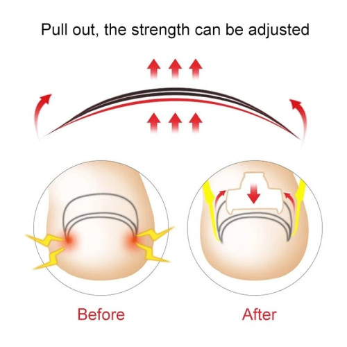 Nail Cutter
